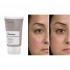 Kem Dưỡng Ẩm The Ordinary Chứa Azelaic Acid Trị Mụn Giảm Thâm Cho Da Dầu Mụn Nhạy Cảm 30ml